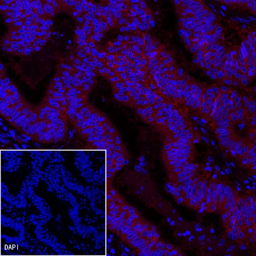 EpCAM Recombinant Rabbit mAb (PE Conjugate) (S-078-13)