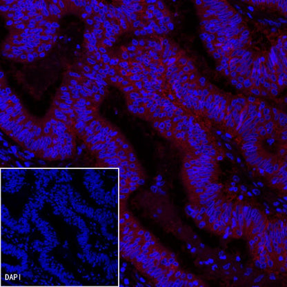 EpCAM Recombinant Rabbit mAb (PE Conjugate) (S-078-13)