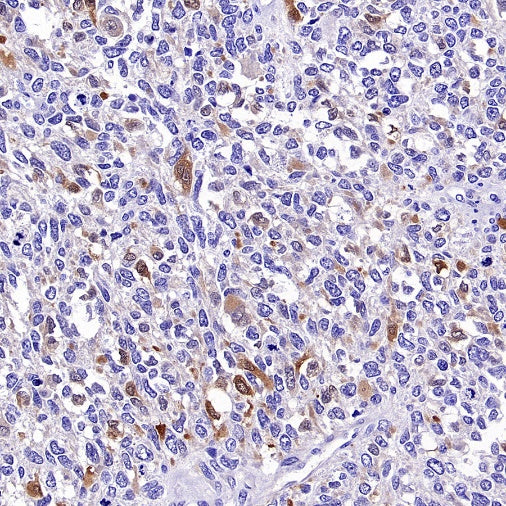 Calretinin Recombinant Rabbit mAb (SDT-2773-21)