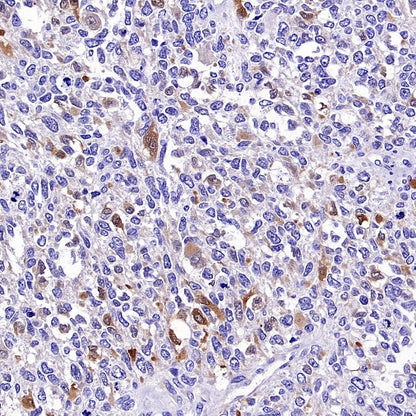 Calretinin Recombinant Rabbit mAb (SDT-2773-21)