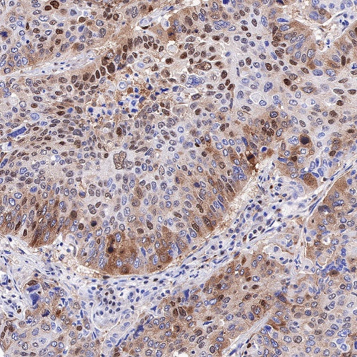 SQSTM1/p62 Recombinant Rabbit mAb (S-778-1)