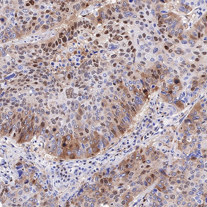 SQSTM1/p62 Recombinant Rabbit mAb (S-778-1)