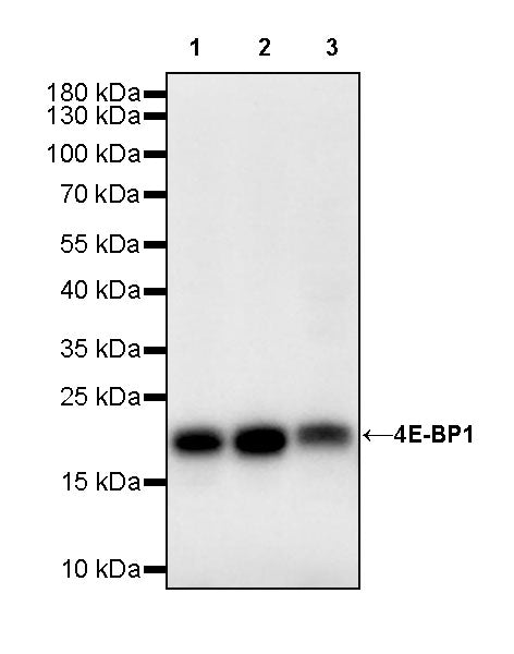 4E-BP1 Recombinant Rabbit mAb (S-4103-65)