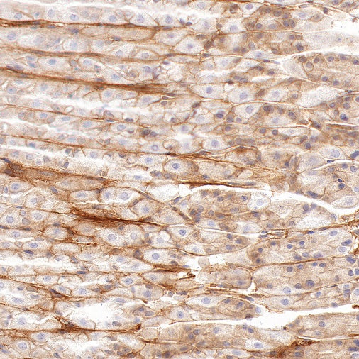 Integrin alpha V Recombinant Rabbit mAb (S-1798-27)