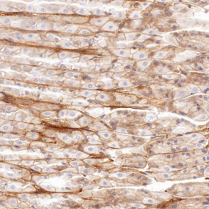 Integrin alpha V Recombinant Rabbit mAb (S-1798-27)