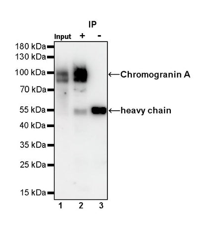 S-RMab® Chromogranin A Recombinant Rabbit mAb (SDT-074-57)