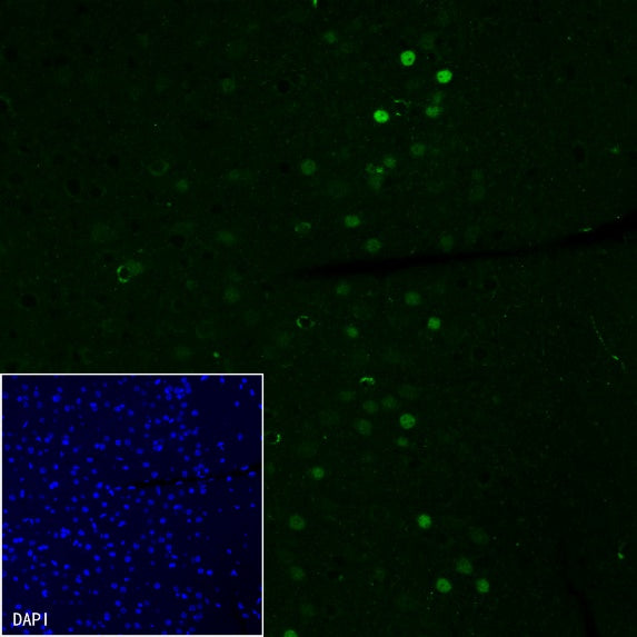 EGR2 Recombinant Rabbit mAb (S-741-136)