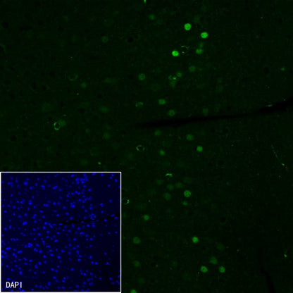 EGR2 Recombinant Rabbit mAb (S-741-136)