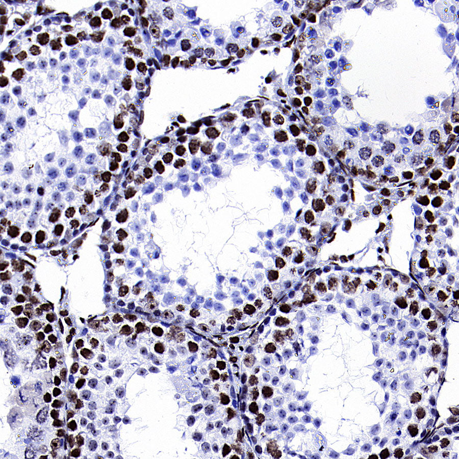 TOP2B Recombinant Rabbit mAb (S-4452-44)