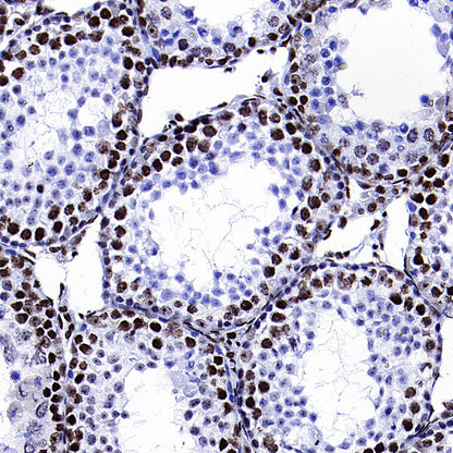 TOP2B Recombinant Rabbit mAb (S-4452-44)