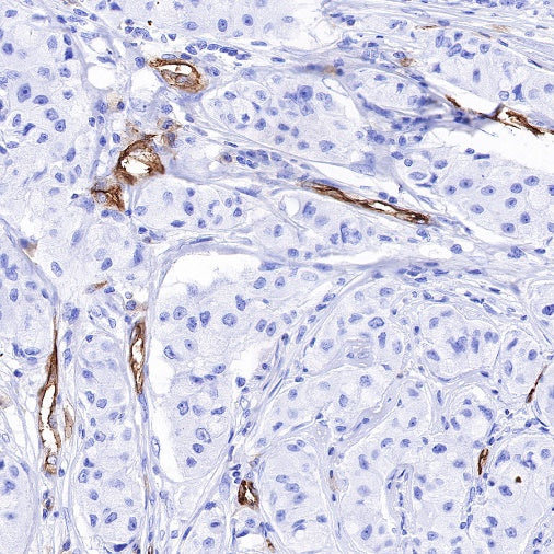 ICAM-2 Recombinant Rabbit mAb (S-R359)