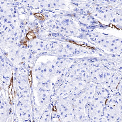 ICAM-2 Recombinant Rabbit mAb (S-R359)