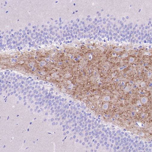 BACE1 Recombinant Rabbit mAb (S-2514-34)