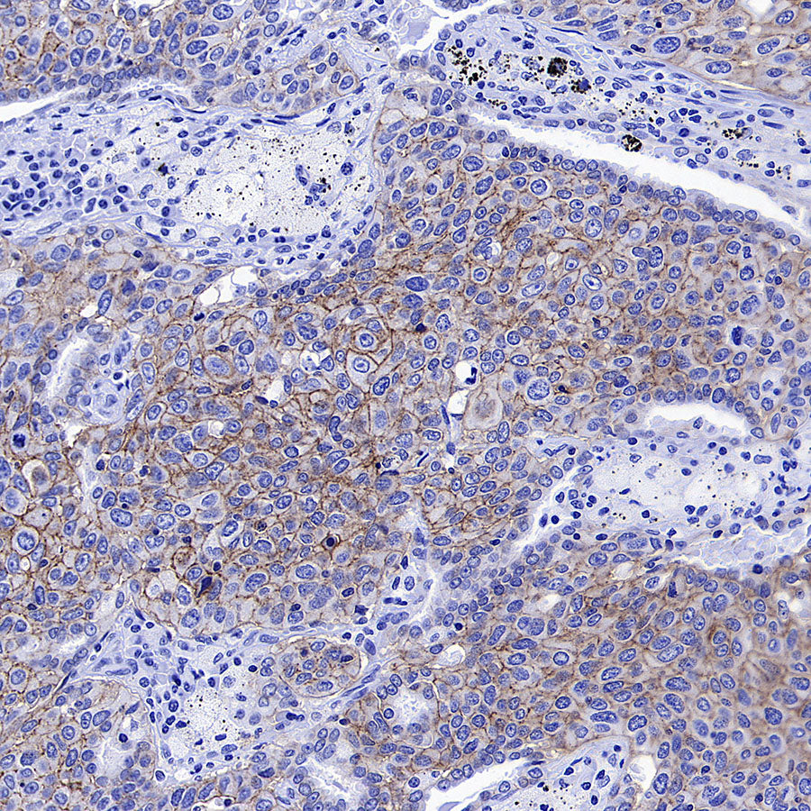 CDCP1 Recombinant Rabbit mAb (S-3437-221)