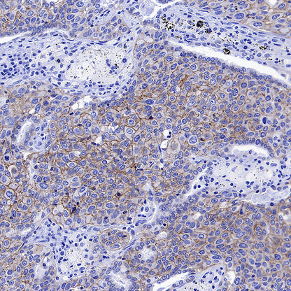 CDCP1 Recombinant Rabbit mAb (S-3437-221)