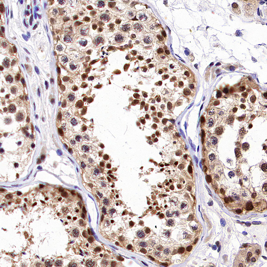 USP5 Rabbit Polyclonal Antibody