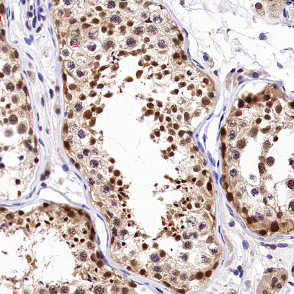 USP5 Rabbit Polyclonal Antibody