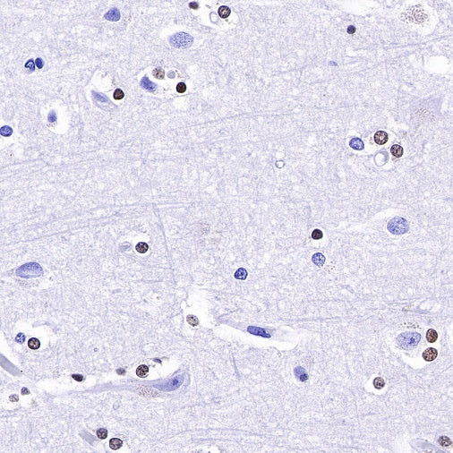 S-RMab® SOX10 Recombinant Rabbit mAb (SDT-R233)