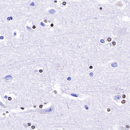 S-RMab® SOX10 Recombinant Rabbit mAb (SDT-R233)