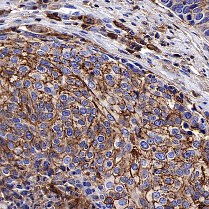 CD44 Rabbit Polyclonal Antibody