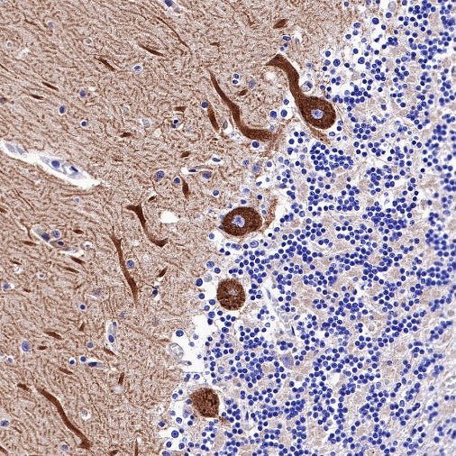 Non-muscle Myosin IIB/MYH10 Recombinant Rabbit mAb (S-299-3)