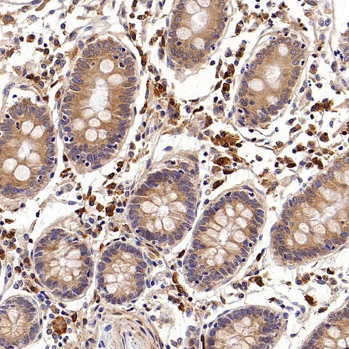 SFRP1 Recombinant Rabbit mAb (S-3071-18)