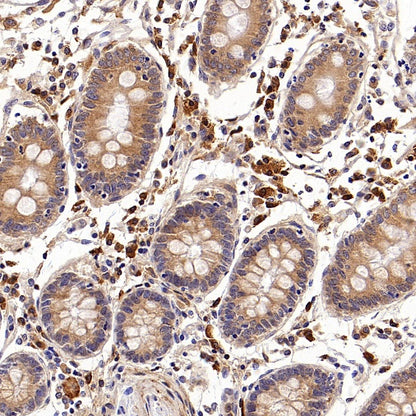 SFRP1 Recombinant Rabbit mAb (S-3071-18)