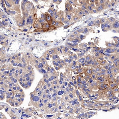 TWEAKR/FN14 Recombinant Rabbit mAb (S-913-1)