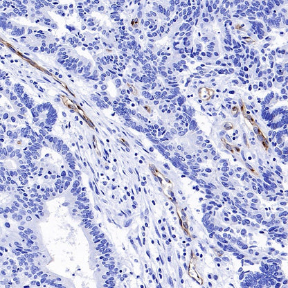 eNOS Recombinant Rabbit mAb (S-1885-94)