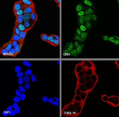 CDK4 Recombinant Rabbit mAb (S-685-210)
