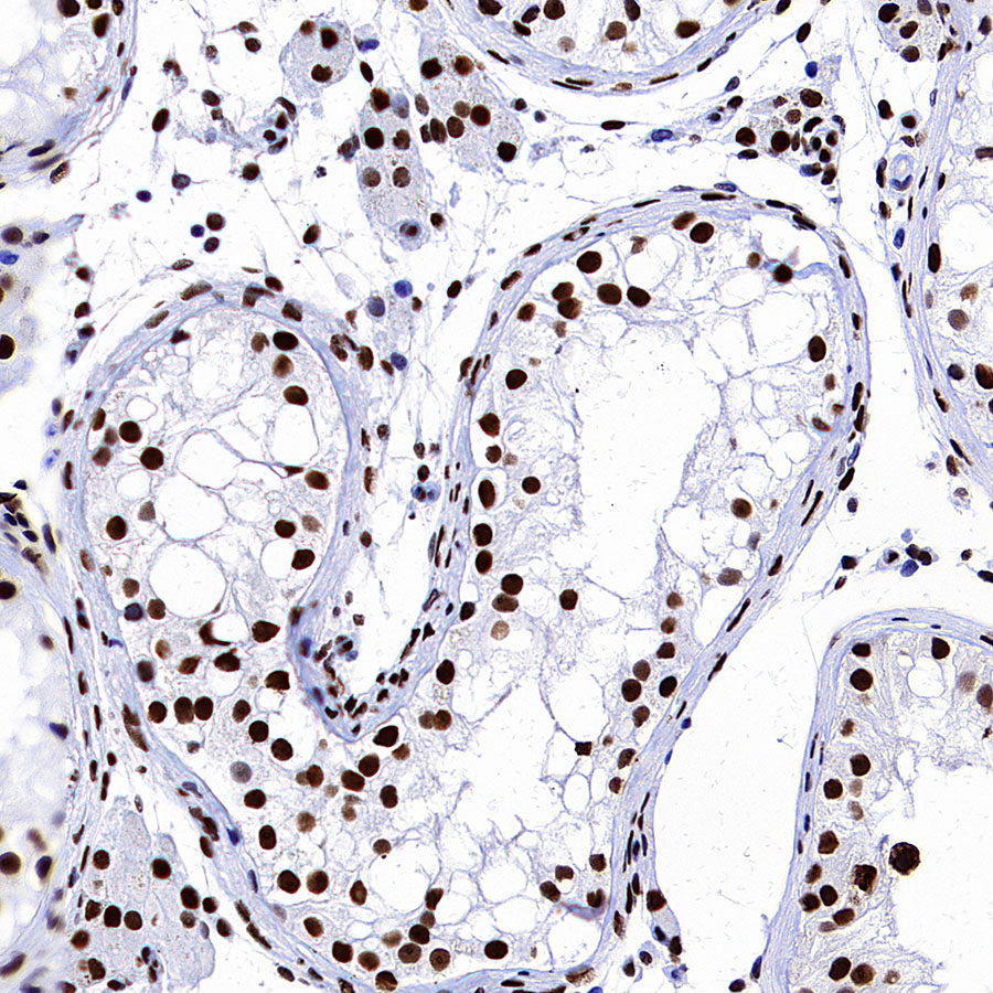 NPM1 Recombinant Rabbit mAb (S-4119-58)