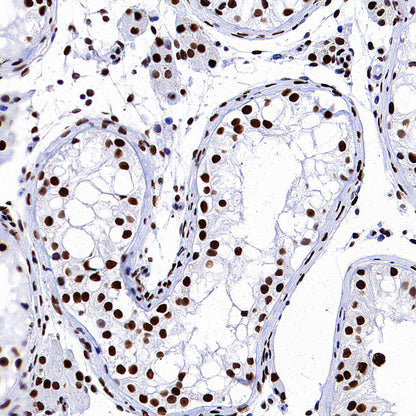 NPM1 Recombinant Rabbit mAb (S-4119-58)