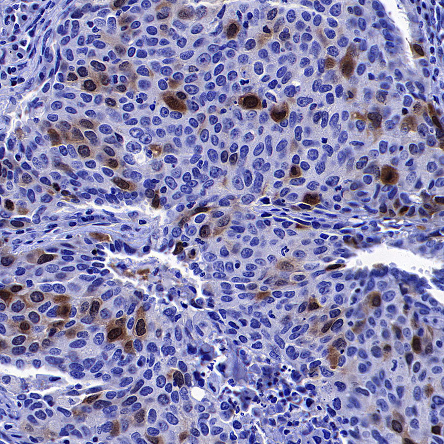 Aurora A Recombinant Rabbit mAb (S-5355)