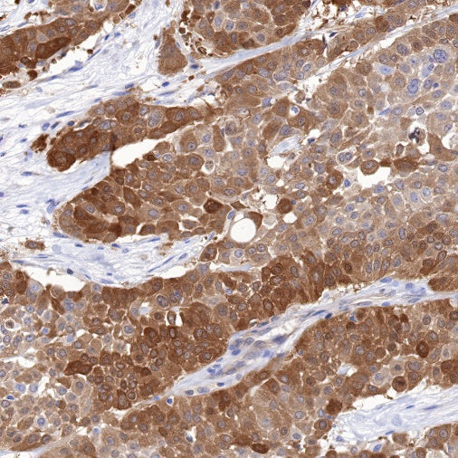 NQO1 Recombinant Rabbit mAb (S-1672-2)