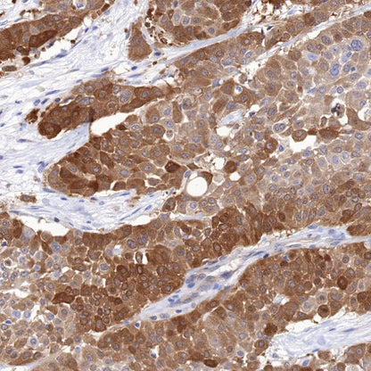 NQO1 Recombinant Rabbit mAb (S-1672-2)