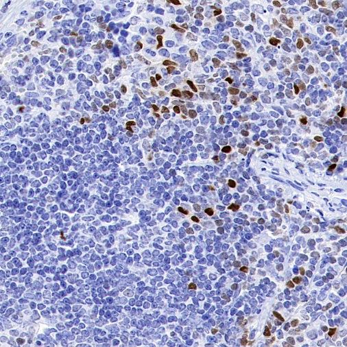 Runx2 Recombinant Rabbit mAb (S-1767-173)