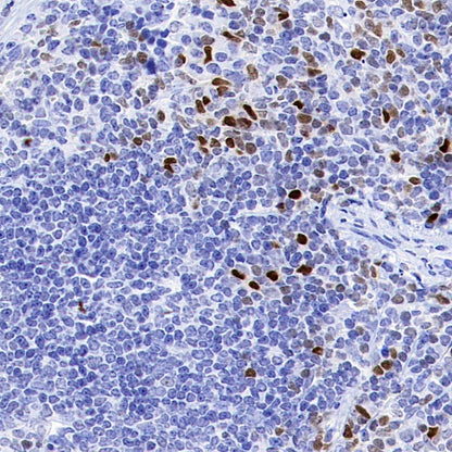 Runx2 Recombinant Rabbit mAb (S-1767-173)