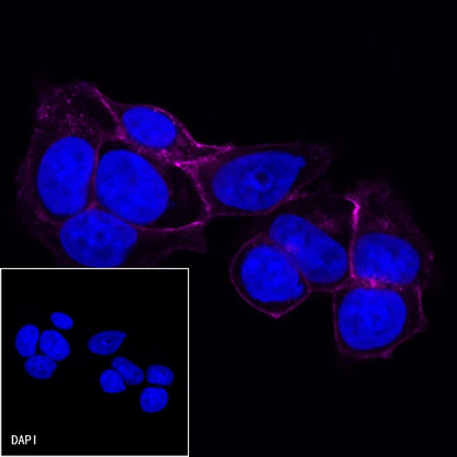 E-Cadherin Recombinant Rabbit mAb (Cy5 Conjugate) (S-438-5)