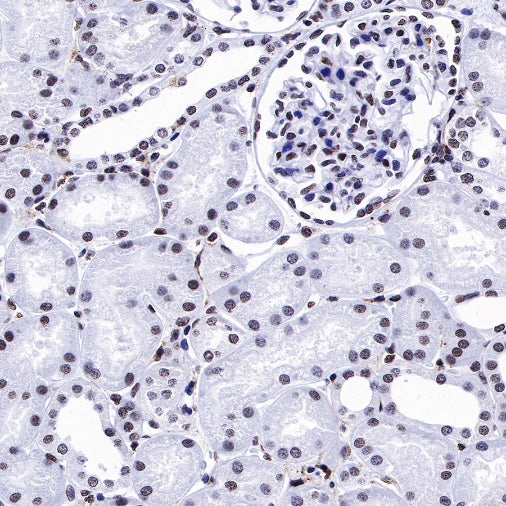 HMGB1 Recombinant Rabbit mAb (S-R305)