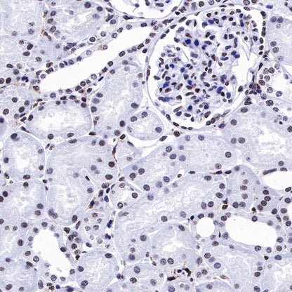 HMGB1 Recombinant Rabbit mAb (S-R305)
