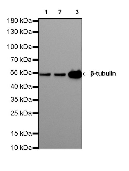 β-tubulin Recombinant Rabbit mAb (SDT-R014)