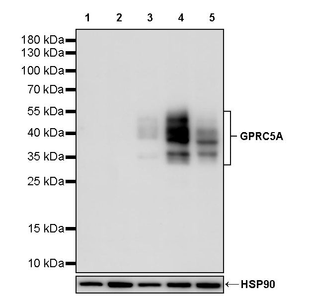 GPRC5A Recombinant Rabbit mAb (S-4383-15)