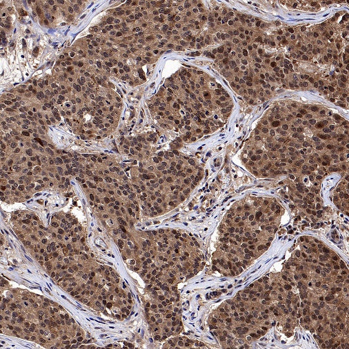 Superoxide dismutase Rabbit Polyclonal Antibody