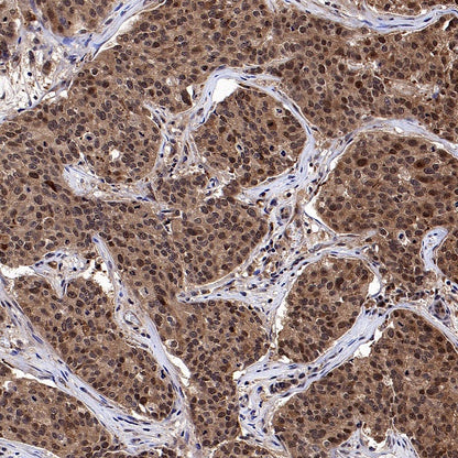 Superoxide dismutase Rabbit Polyclonal Antibody