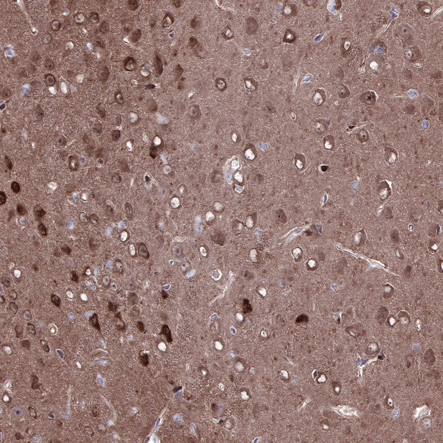 PTEN Recombinant Rabbit mAb (SDT-R074)