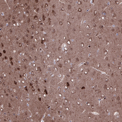 PTEN Recombinant Rabbit mAb (SDT-R074)