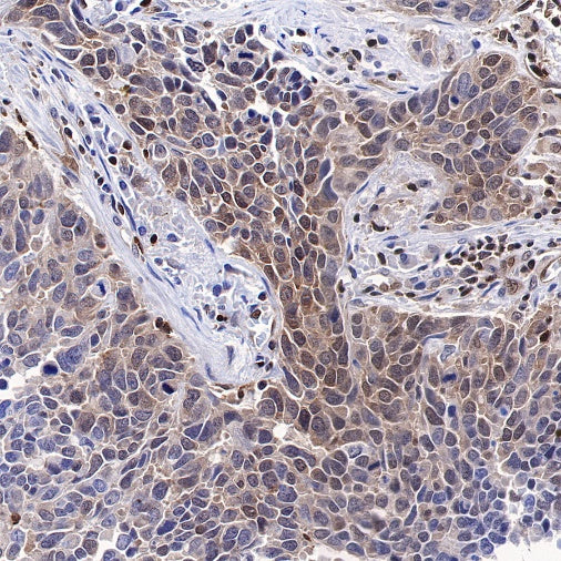 MEK3 Recombinant Rabbit mAb (S-835-23)