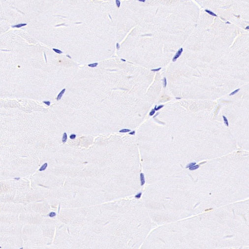 LPA Rabbit Polyclonal Antibody