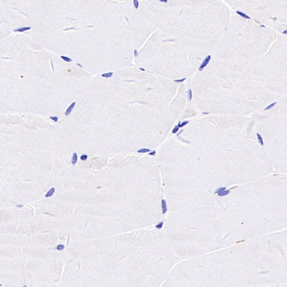 LPA Rabbit Polyclonal Antibody