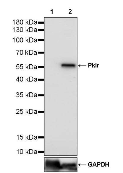 Pklr Recombinant Rabbit mAb (S-4114-40)
